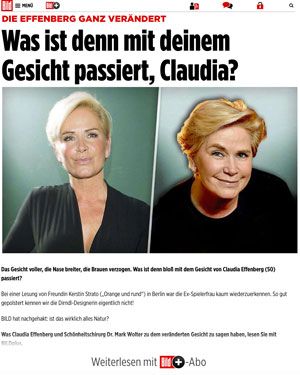 Die Effenberg ganz verändert | Was ist denn mit deinem Gesicht passiert, Claudia?